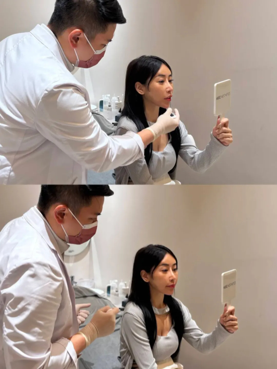 選擇楊育杰醫師：美感比劑量更重要｜見證案例-Angel緁希